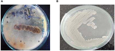 Enhancing antibacterial efficacy and accelerating infectious wound healing in rats using biogenic metal nanoparticles from marine Bacillus subtilis